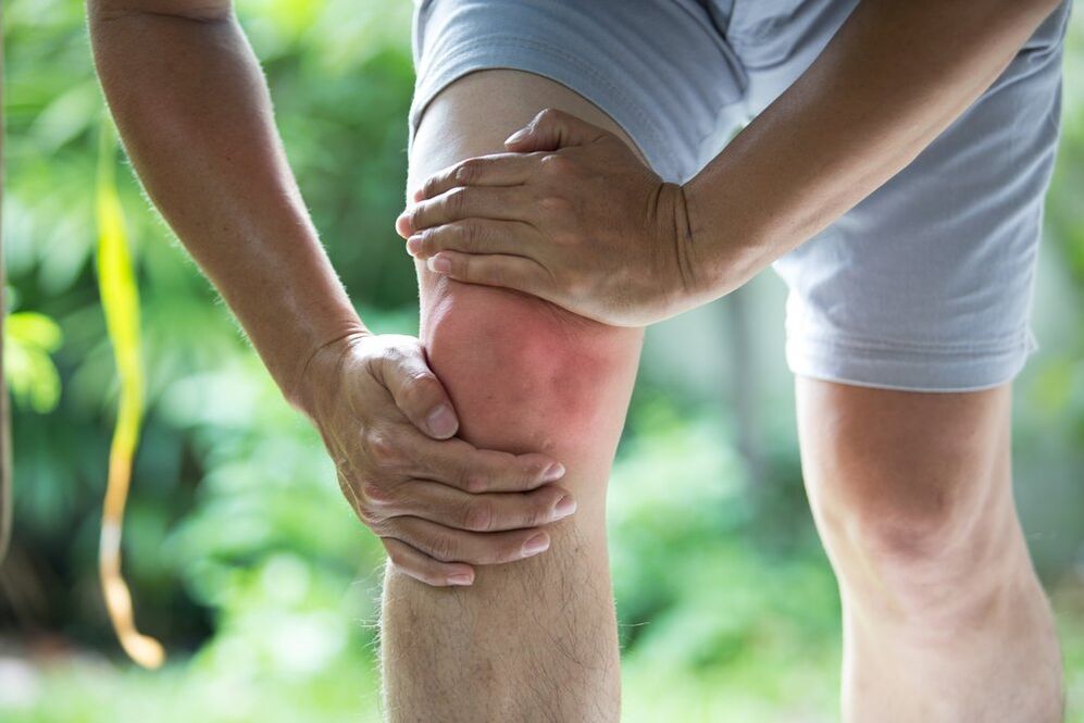 Joint pain is the most obvious manifestation of joint disease and arthritis. 