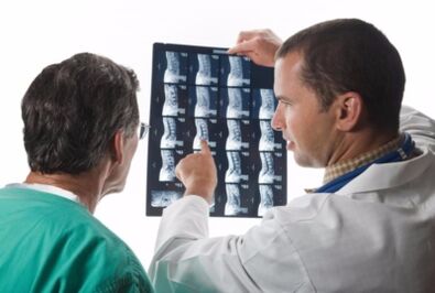 Doctor's spine pictures