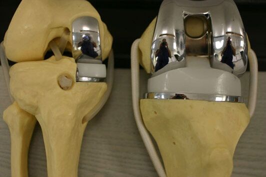 Variants of the endoplasmic knee joint