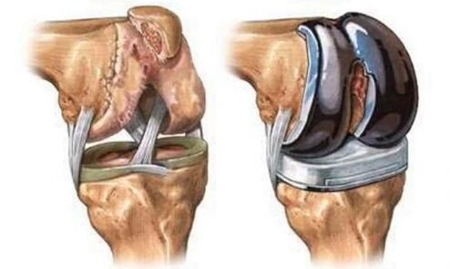 Inner opthetics of the knee joint