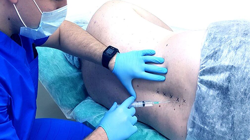 Spinal block for osteochondrosis