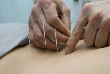 Acupuncture treatment of thoracic osteochondrosis