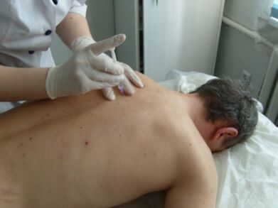 Intra-articular injection of chondroprotective agents in the treatment of thoracic osteochondrosis