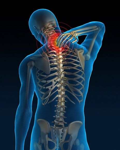 Neck pain aggravated in the initial stage of cervical osteochondrosis treatment